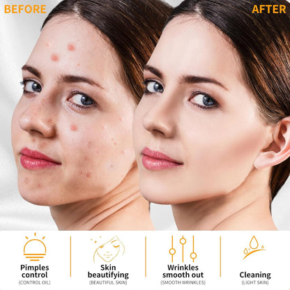 MYSWEETY High F Rrequncy Portable Handheld Facial Skin Care Wand Machine