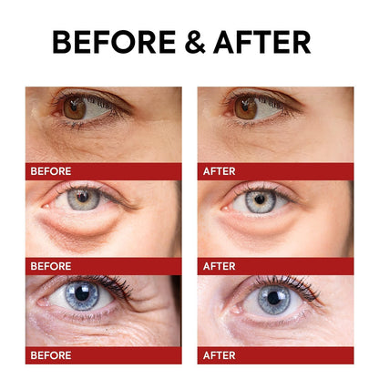 Rapid Reduction Retinol Eye Cream: Under Eye Cream Instantly Reduces Wrinkles Fine Lines Under Eye Bags Puffiness Dark Circles Crow's Feet - Rapid Face Lifting Tightening Firming 1 OZ/15G