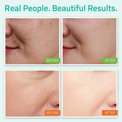 YEOUTH Hyaluronic Acid Serum with Vitamin C, Face Toner, Face Moisturizer, Skin Care Set for Radiant and Smooth Skin, Gifts for Women, Self Care Routine, Skin Care Gift Set 3-Piece