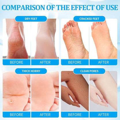 Pedicure Kit Foot Soak Set: Bubble Salt, Sugar Scrub, Massage Mask, Massage Lotion in a Box, 4 Step Foot Spa Kit for Dry Feet, Calluses and Tired Feet(3 Set Pacific Waves)