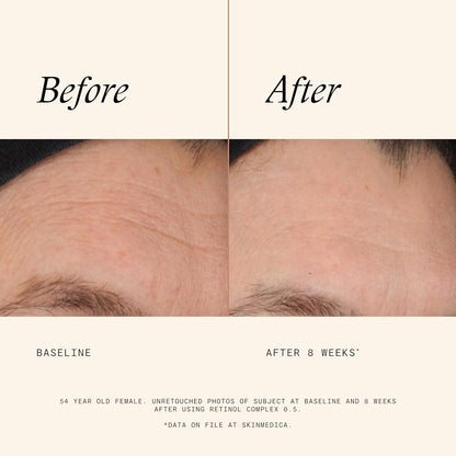 SkinMedica Retinol 0.5 Complex - Retinol Serum for Face, Age-Defying Advanced Retinol Cream That Renews Skin and Diminishes the Appearance of Fine Lines and Wrinkles, 1 Fl Oz