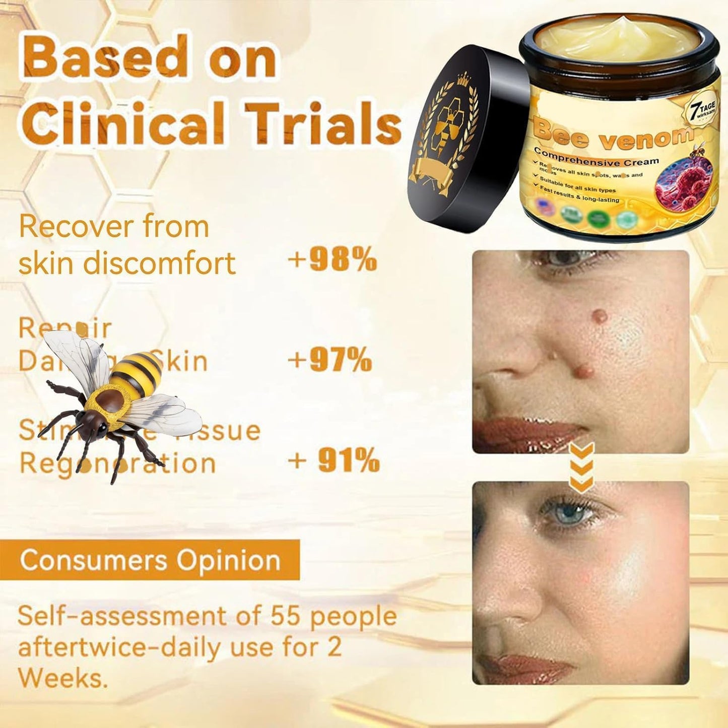 Bee Venom Comprehensive Bee Cream,2025 Professional Treatment Cream Wrinkle Removal Anti-Aging Moisturizing,Effective In Reducing Skin Blemishes (2PCS)