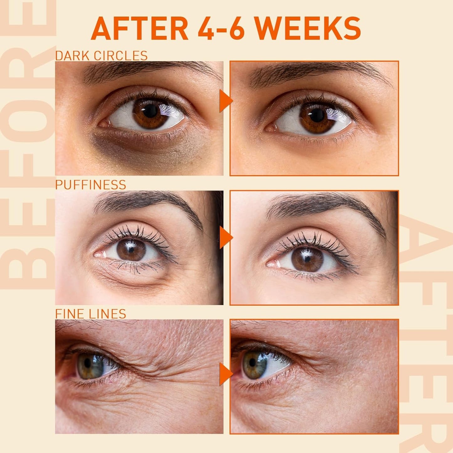 Under Eye Serum For Puffiness: Caffeine Under Eye Treetment Raducing Eye Begs and Derk Circles In 2 Week - Eye Wrinkles & Fine Lines Smoothing Cream for Late Nights, Overtime and Makeup Prep - 12 ML