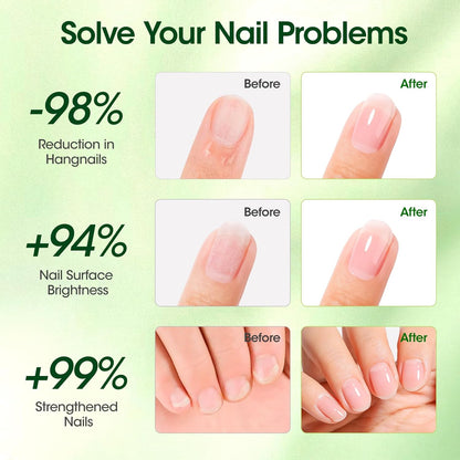 Gellen Cuticle Oil, Roll-On Nail Growth Oil, Nail Oil for Nail Growth & Repair & Strength, Green Citrus Avocado Baobab Oils Vitamin E, Nail Care for Damaged Skin & Thin Nails, Soften & Nourish Cuticle