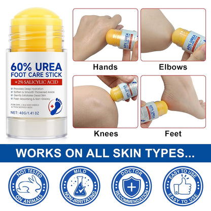 60% Urea Foot Cream with 2% Salicylic Acid, Feet Moisturizer Cream for Dry Cracked Heels, Urea Foot Cream Nourish Cracking Rough Dry Heels, Feet Callus Remover, 1.41Fl Oz