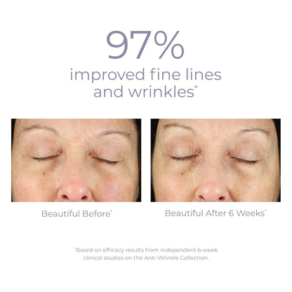 Derma E Anti-Wrinkle Eye Treatment – Anti-Aging Eye Cream with Retinol, Grape Seed Extract and Reishi Mushroom – Hydrating Eye Serum for Under Eye and Eyelids, 1/2 oz