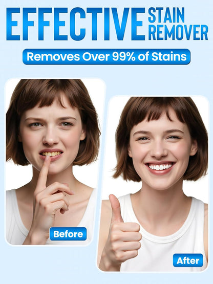 Teeth Whitening Kit for Sensitive Teeth: Nicwell LED Light +35% Carbamide Peroxide Whitening Gel & 1 Desensitizing Pen - Dental Grade Results - Overnight Daily-use Aged 25-35 with Travel Case