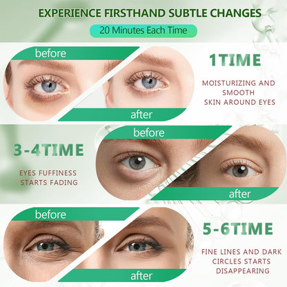 60 Pcs Green Under Eye Patches, 30 Pairs Undereye Mask for Dark Circles Puffy Eyes Treatment, Collagen Gel Pads Hydrating for Eye Bags Puffiness Wrinkle, Women Men Beauty Skin Care Products