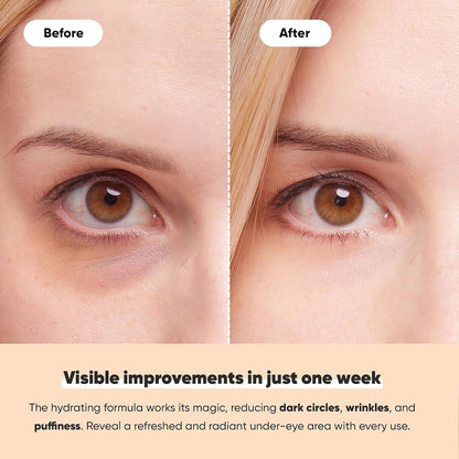 LE GUSHE Under Eye Mask & Under Eye Patches (10 Pairs) - Gold Eye Mask with Collagen & Amino Acid, Cooling Eye Care for Wrinkles, Puffy Eyes & Dark Circles, Brightening Skincare