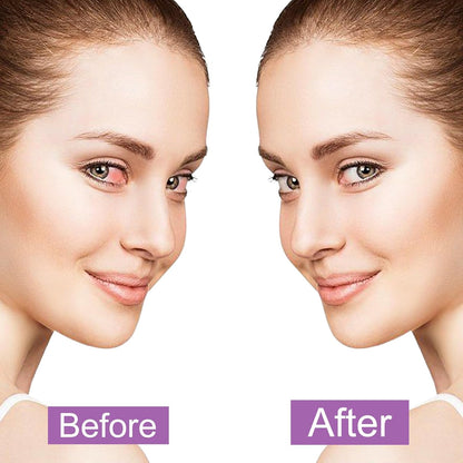 20 Packs Steam Eye Masks for Dry Eyes and Puffiness,Disposable Heated Eye Mask Warm Compress for Eyes,Relief Eye Fatigue Hot Sleep Mask for Men Women,Lavender