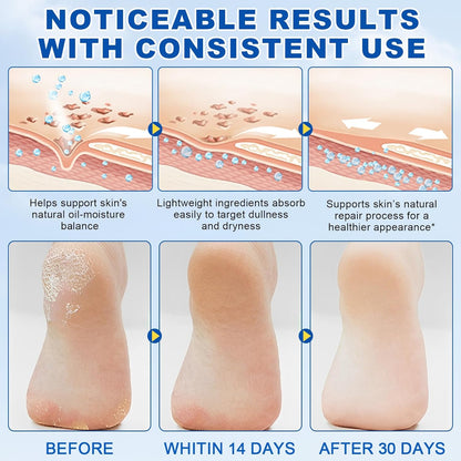 60% Urea + 2% Salicylic Acid Foot Cream–Ultra-Moisturizing Formula, Exfoliates Dead Skin, Softens Dry, Cracked Skin on Feet, Knees, Hands, Elbows. Helps soften callused, rough, or tender areas 2.82oz