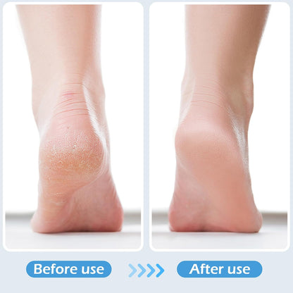 3 Pcs 4 in 1 Foot Brush for Use in Shower with Pumice Stone, Foot Rasp and Sandpaper, Foot Scrubber Brush for Feet, Dead Skin Remover for Foot Care