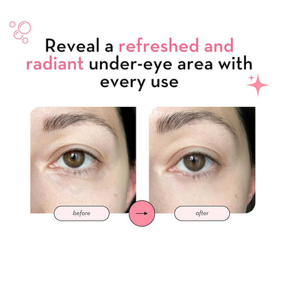 Elizabeth Mott Under Eye Patches with 24K Gold, Collagen, Niacinamide & Peptides - Hydrating & Brightening Eye Mask for Puffy Eyes and Wrinkles - Gifts for Women, Cruelty Free