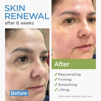 Collagen Face Cream with Stem Cells Retinol Hyaluronic Acid Niacinamide for All Skin Types - Anti-Aging Face Moisturizer with Airless Pump - Day & Night Cream for Wrinkles - Made in USA 1.7 Oz