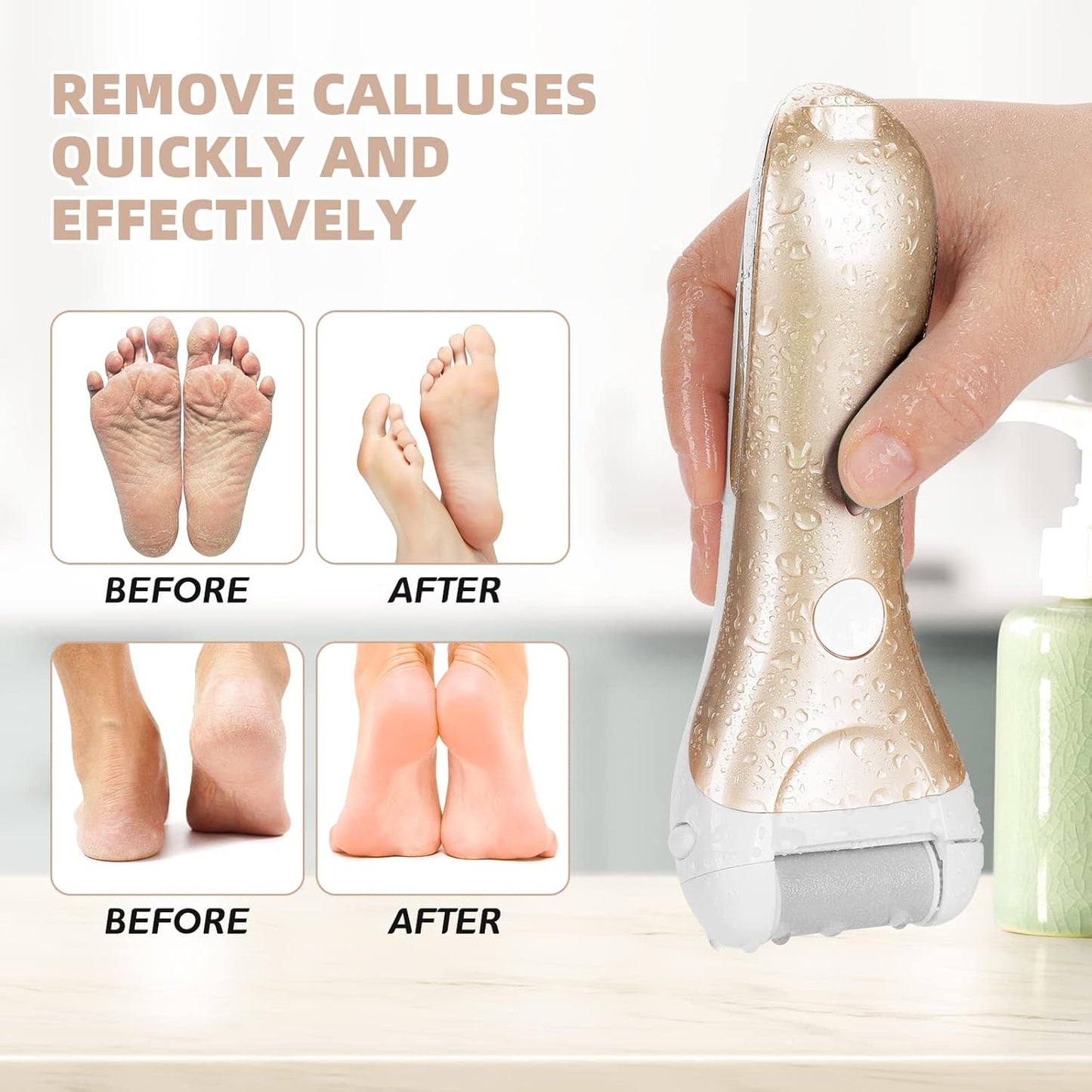 Callus Remover for Feet, Nicebirdie Electric Foot File Callus Removers Rechargeable Waterproof Pedicure Tools Foot Scrubber Shaver Feet Care Tool for Cracked Heels Dead Skin （Golden）