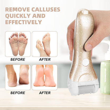 Callus Remover for Feet, Nicebirdie Electric Foot File Callus Removers Rechargeable Waterproof Pedicure Tools Foot Scrubber Shaver Feet Care Tool for Cracked Heels Dead Skin （Golden）