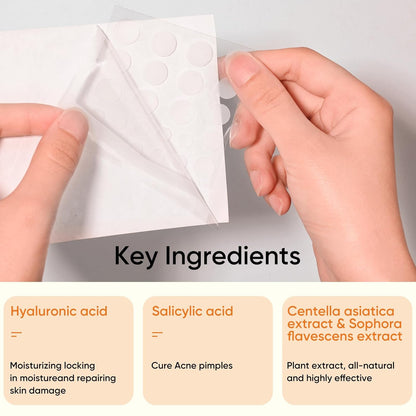 Microdart Acne Patches for Face(18 Counts) & Salicylic Acid Pimple Patches(36 Counts), Fast-Acting Zit Patches for Pimples & Blemishes, Target Early Stage & Deep Pimples