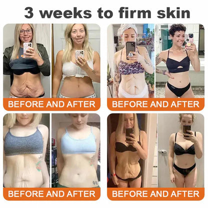 Bee Venom Skin Restoration Cream,Natural Bee Venom Comprehensive Cream,Effectively Firms skin and Reduces Imperfections Anti-Wrinkle Moisturizing for All skin Typess (2PCS)