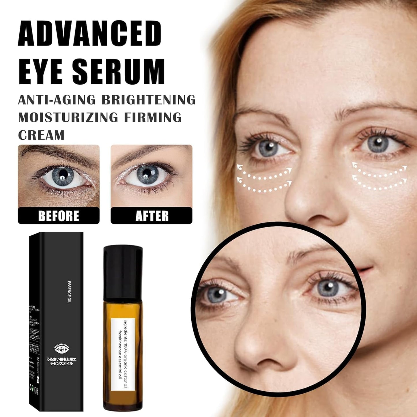 Time Eraser Rollerball Castor Oil And Frankincense, Castor Oil Roller Ball With Frankincense, Castor Oil Roller Ball With Frankincense Under Eye Reduces Fine Lines, Anti Wrinkle Serum For Eye (2 Pcs)