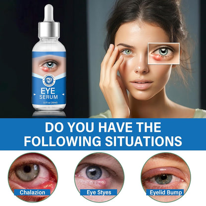 Eye Treatment, Effective Eye Serum for Chalazion and Blepharitis Treatment, 30mL Gentle Lash and Eye Cleanser, Blue