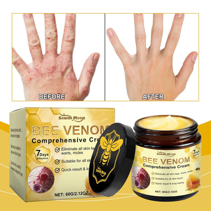 2PCS Bee Venom Skin Treatment Cream, 2025 Bee Venom Comprehensive Cream for All Skin Types, Skincare Treatment Creams, Visibly reduces blemishes