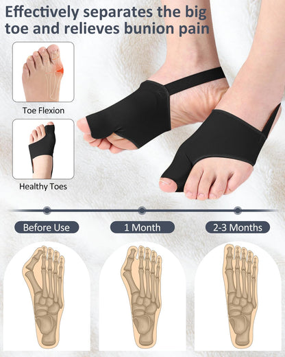 2PC Bunion Corrector for Women Men Toe Pain Relief, Breathable Big Toe Straightener Spacers, Bunion Correction Socks Splint with Built-in Gel Pad and Adjustable Straps