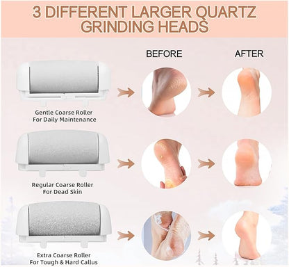 Callus removers 8 pack replacement