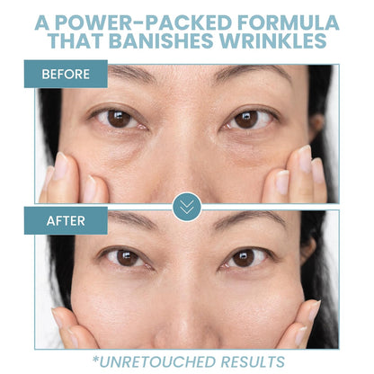 Anti-Aging Eye Gel - Luxurious Hydrating Under Eye Cream For Dark Circles and Puffiness, Bags, Crows Feet, Wrinkles - With Hyaluronic Acid & Skin-Firming Peptides Eye Serum (2 oz.)