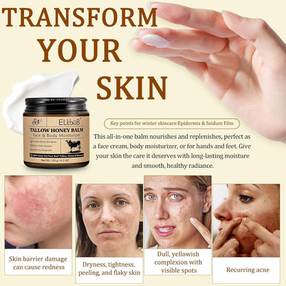 Whipped Tallow Cream for Face & Body - 100% Grass-Fed Beef Tallow, Natural Honey & Beeswax Moisturizer, Deep Hydration & Nourishment, Oil-Free & Unscented, Fast Absorbing