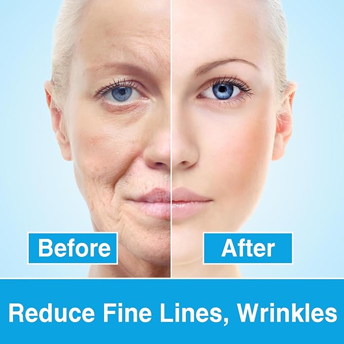 Botox stock solution facial serum,