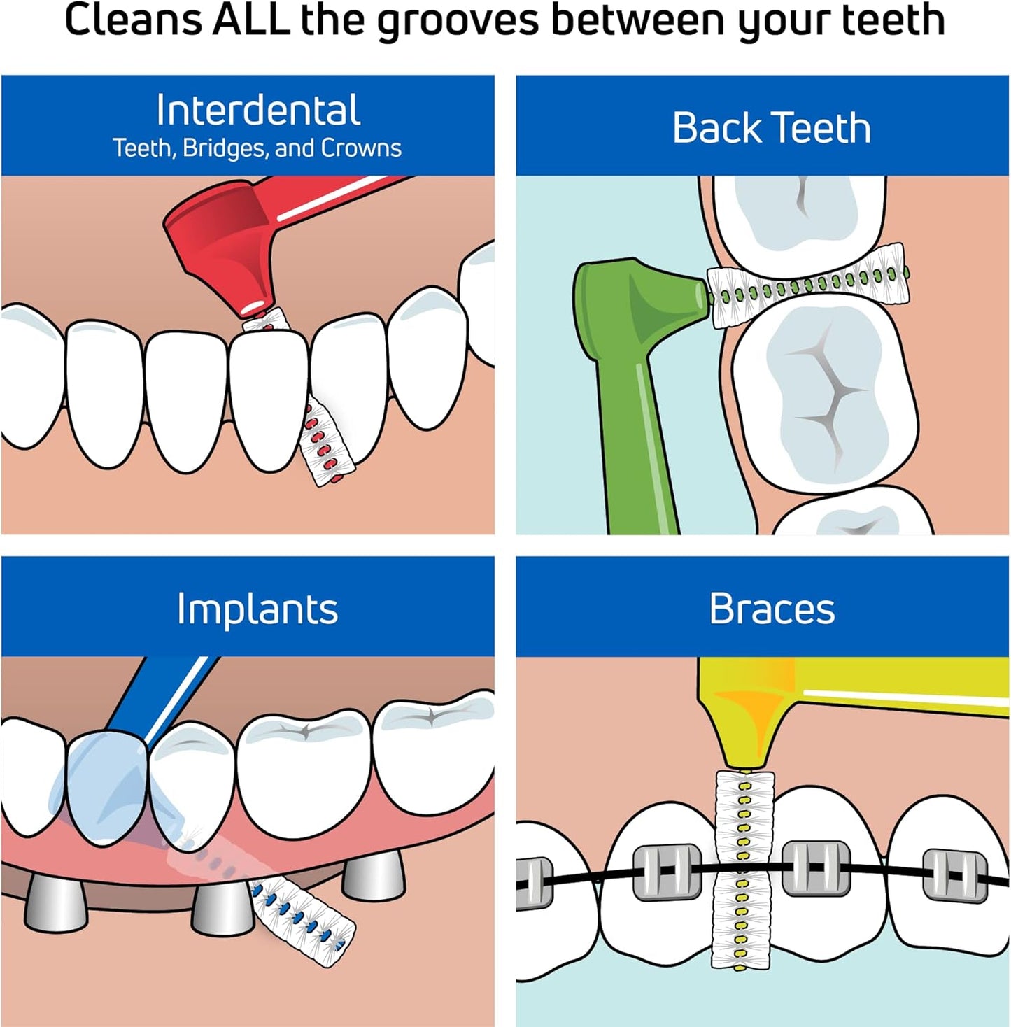 TePe Interdental Brush Angle, Angled Dental Brush for Teeth Cleaning, Pack of 25, 0.40 mm, Extra-Small/Small Gaps, Pink, Size 0