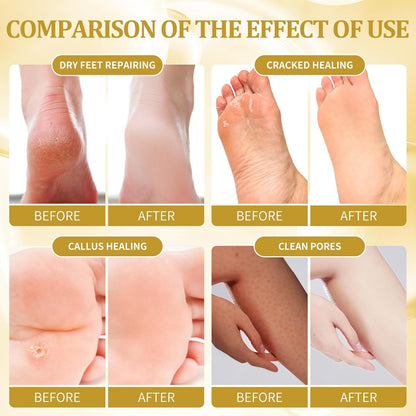 Pedicure Kit Foot Soak Set: Bubble Salt, Sugar Scrub, Massage Mask, Massage Lotion in a Box, 4 Step Foot Spa Kit for Dry Feet, Calluses and Tired Feet(1 Set Honey Flower)