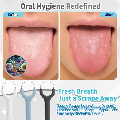 3-Pack Colorful Tongue Scraper for Adults, Stainless Steel, Metal Tongue Brush for Bad Breath, Oral Hygiene Tool, Easy to Use & Portable