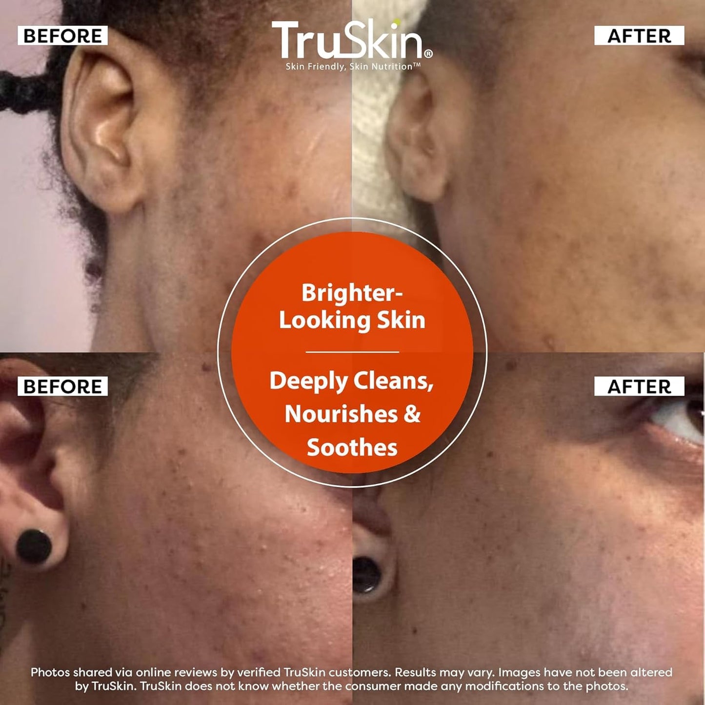 TruSkin Vitamin C Cleanser for Face - Brightening Face Wash with Vitamins C & E, Rosehip Oil, Aloe Vera and MSM - Deep Clean and Refresh for Radiant, Healthy-Looking Skin, 4 fl oz