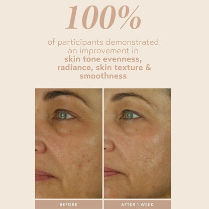 SHANI DARDEN SKIN CARE Retinol Reform with 1% Encapsulated Retinol Serum for Face & Neck, Gentle Slow-Release Retinol Face Serum with Tripeptide for Wrinkles, Fine Lines & Uneven Tone, 0.3 fl oz