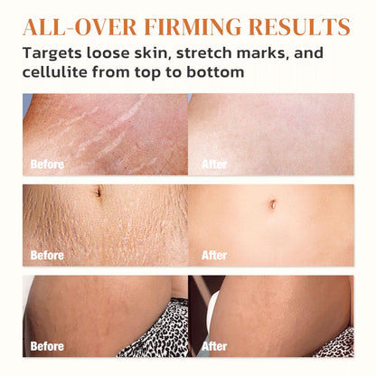 B Flat Belly Firming Cream – Skin Tightening Cream for Body: Lift & Tone Tummy, Thighs, Booty & Arms – Stretch Mark & Cellulite Sculpting Lotion for Women – 3.38 Fl Oz