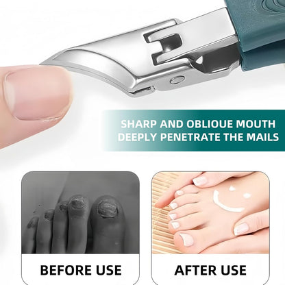 9-Piece Ingrown Toenail & Thick Nail Clipper, Eagle Beak Beveled Nail Clippers,Angled Nail Clippers,Suitable for Men,Women,and Comfort-Seeking Seniors at Home,in The Office,and During Travel (Black)