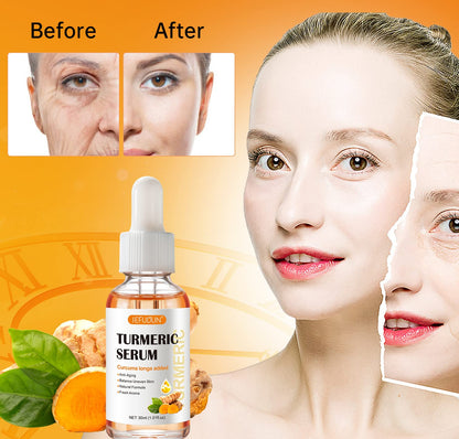 Turmeric Serum for Dark Spots 1 Fl Oz, Turmeric Dark Spot Corrector Serum for Face & Body, Anti Aging Facial Serum for Women and Men, Reduces Hyperpigmentation, Age Spots, Sun Spot, Improve Skin Tone