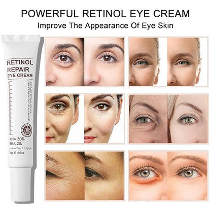 Retinol eye cream with retinol