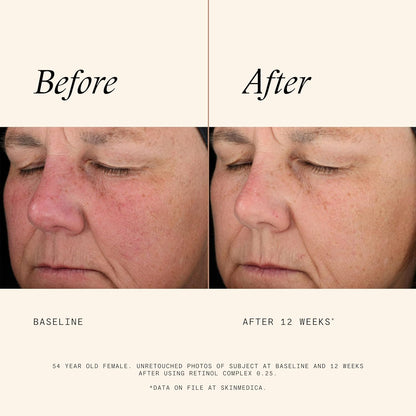 SkinMedica Retinol 0.25 Complex - Retinol Serum for Face, Age-Defying Advanced Retinol Cream That Renews Skin and Diminishes the Appearance of Fine Lines and Wrinkles, 1 Fl Oz