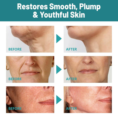 Crepes skin cream for aging skin ，Crepes Skin Repair Treatment, Firming Cream with Hyaluronic Acid & Shea Butter to Deeply Moisturize & Tighten Wrinkly Dry