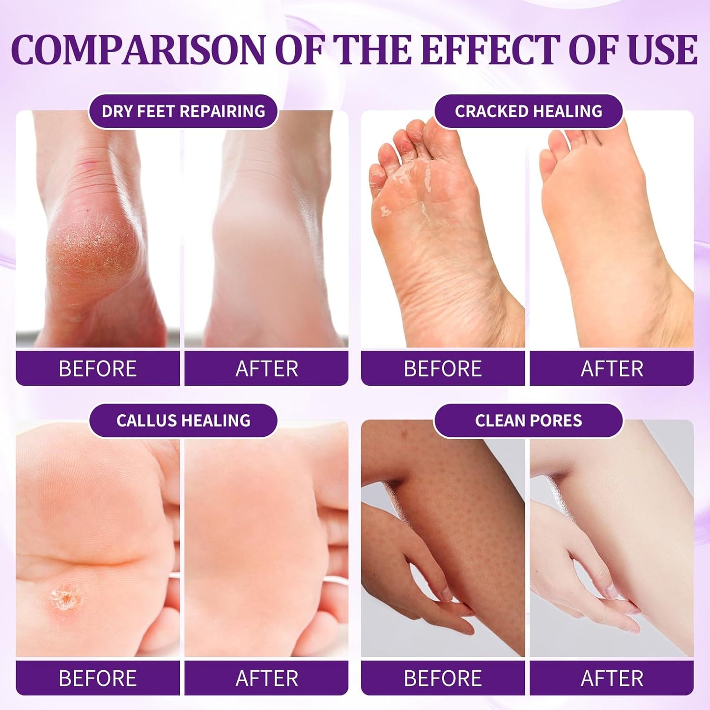 24 PCS Foot Soak, Pedicure Kit Foot Soak Set With Bubble Salt, Sugar Scrub, Massage Mask, Massage Lotion In a Box 4 Step Foot Spa Kit For Dry Cracked Feet, Tired Feet, 6 Set Lavender