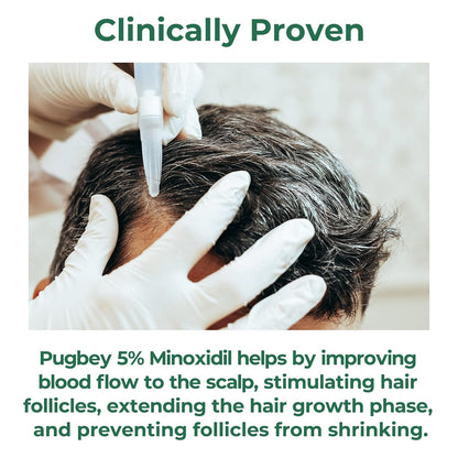 5% Minoxidil for Men, Minoxidil Spray for Women Hair Growth, Beard and Hair Growth Serum, Regrowth Treatment, 3.38 Fl Oz, 2 Month Supply