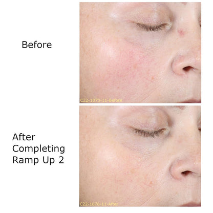 Hydrate & Soothe Beauty Collection Gift Bundle / Starter Kit, Activator with 0.05% Retinol Cream, Ramp-Up Regimen 2 & RHR Overnight Mask, Skin Care Routine, For All Skin Type