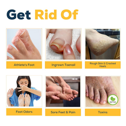 Citrus Detox Foot Soak with Epsom Salts – for Foot Callus, Damaged Toenail Appearance, Pedicure Spa, and Soothing Sore, Tired Feet – Made in USA – 16oz