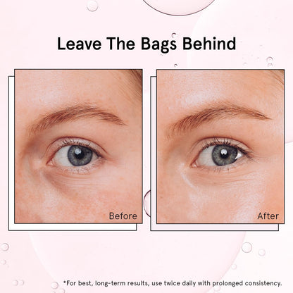 grace & stella Under Eye Brightener Roller - Airplane Travel Essentials - Travel Size Toiletries - Retinol & Caffeine Eye Serum for Puffiness, Dark Circles, Wrinkles - Vegan Skincare (15ml / 0.51floz)