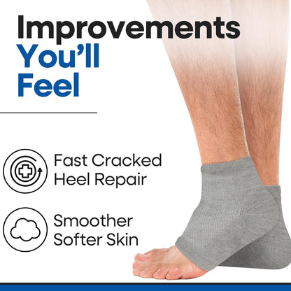 Moisturizing Socks for Men & Women | Aloe Vera Cracked Heel Treatment | Foot Callus Remover | Aloe Socks for Cracked Heels & Dry Feet | Lotion Infused Gel Heel Sleeves (Large - 2 Pairs)