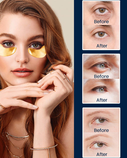 Caffeine Eye Cream and 24K Gold Eye Mask (20 pcs): Under Eye Serum for Dark Circles and Puffiness Eye Care Eye Serum Anti Aging with 360° Massage Ball Reduce Eye Bags, Wrinkles and Fine Lines