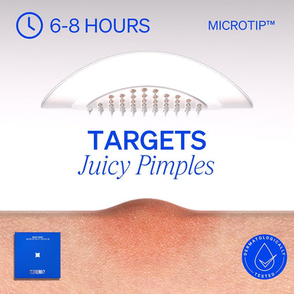 RIGHT AWAY Microtip Hydrocolloid Acne Pimple Patch for Early Stage Zits and Hidden Blemish (8 Patches) Microdart Patch