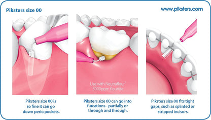 Piksters Interdental Brushes, 40 pk, Size 00, Interdental Tooth Brush for Extremely Tight Gaps, Gum Soft Bristles for Plaque Removal, Safe for Braces